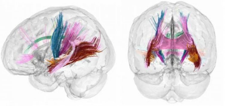 मां बनने से सचमुच बदल जाता है महिला का दिमाग