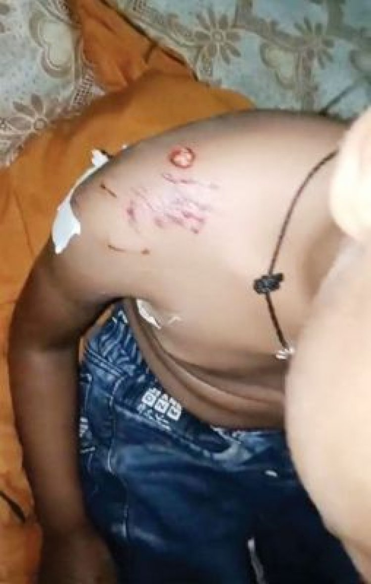 कुत्ते के हमले से मासूम सहित 3 घायल