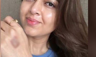 'सेलिब्रिटी मास्टरशेफ' के सेट पर घायल हुईं तेजस्वी प्रकाश, सोशल मीडिया पर प्रशंसकों को दी जानकारी