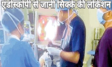 डॉक्टरों की बड़ी सफलता: बच्चे ने निगला सिक्का, बिना ऑपरेशन एंडोस्कोपी के माध्यम से निकाला