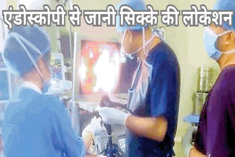 डॉक्टरों की बड़ी सफलता: बच्चे ने निगला सिक्का, बिना ऑपरेशन एंडोस्कोपी के माध्यम से निकाला