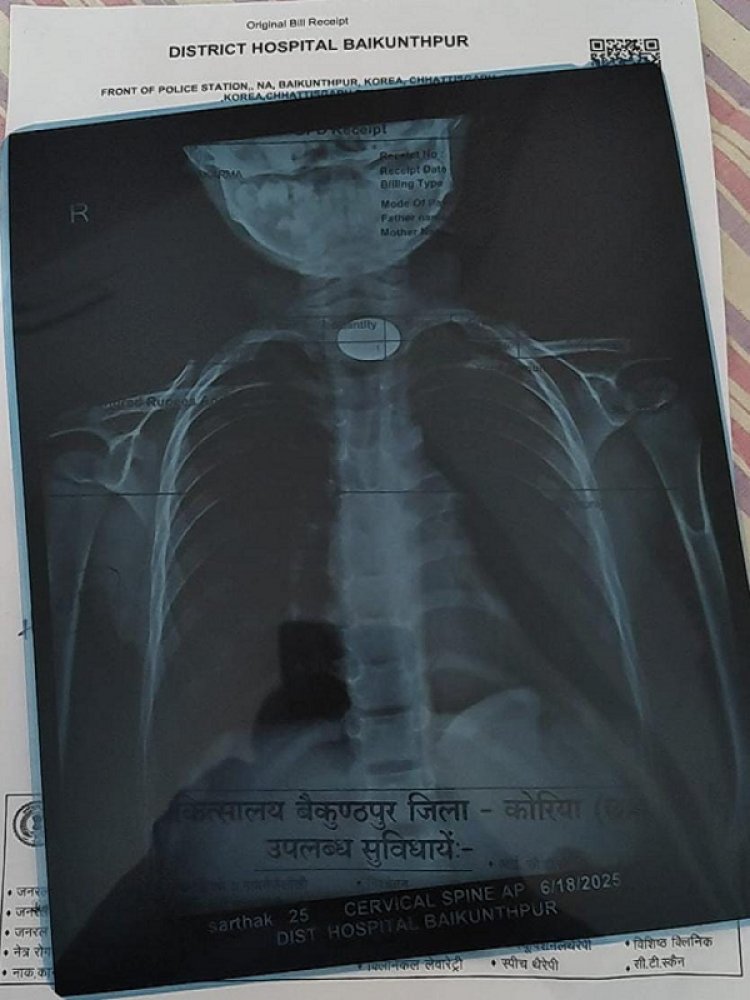 बच्चों को सिक्का, पिन, सुई, कांच, छोटी गिट्टी या छोटी वस्तुओं से दूर रखें : डॉ. प्रशांत सिंह