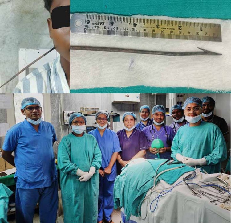 बच्चे के चेहरे में घुसे लोहे के औजार को निकाला, डॉ. हंसा बंजारा और टीम ने रचा कीर्तिमान